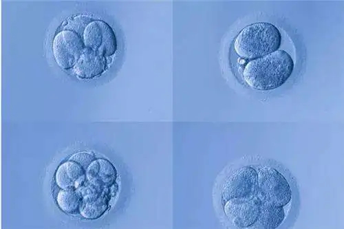 试管婴儿什么时候开始打针？和自然受孕出生孩子有差别吗？