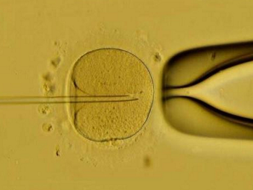 试管婴儿专家解读：不孕不育是否可以遗传？