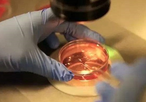 美国试管婴儿阻隔274种遗传病