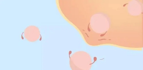 试管婴儿90%不是自己的？这种说法可信吗？