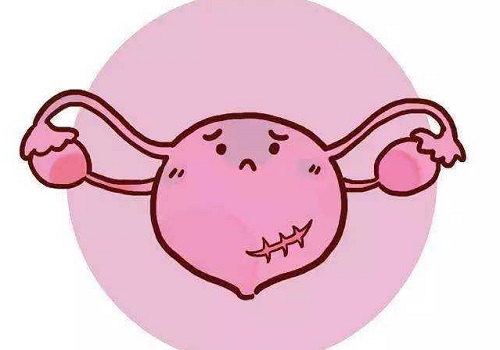 试管婴儿取卵痛吗